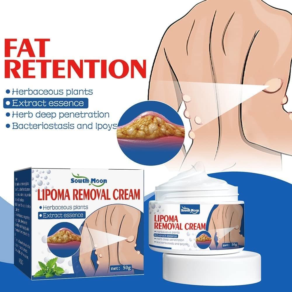 Lepoma Removal Cream
