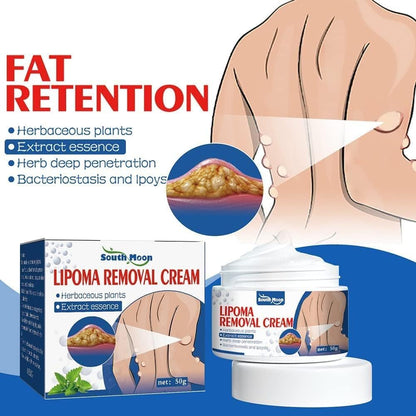 Lepoma Removal Cream